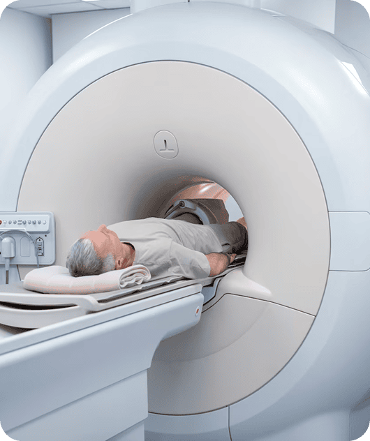 CT Angiography (CT Angio)